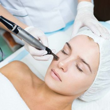 Dermapen_y_Plasma_Rico_en_Plaquetas